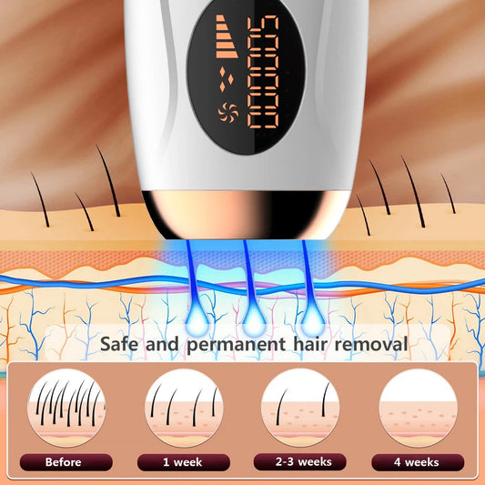 Inovia™ Portable IPL Laser Epilator MedikStat