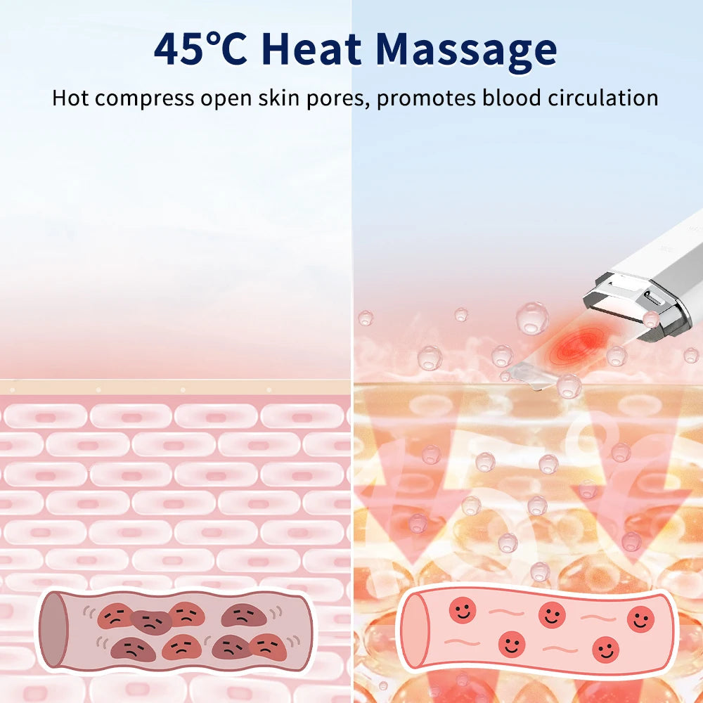 Sanclair™ Ultrasonic Skin Scrubber MedikStat