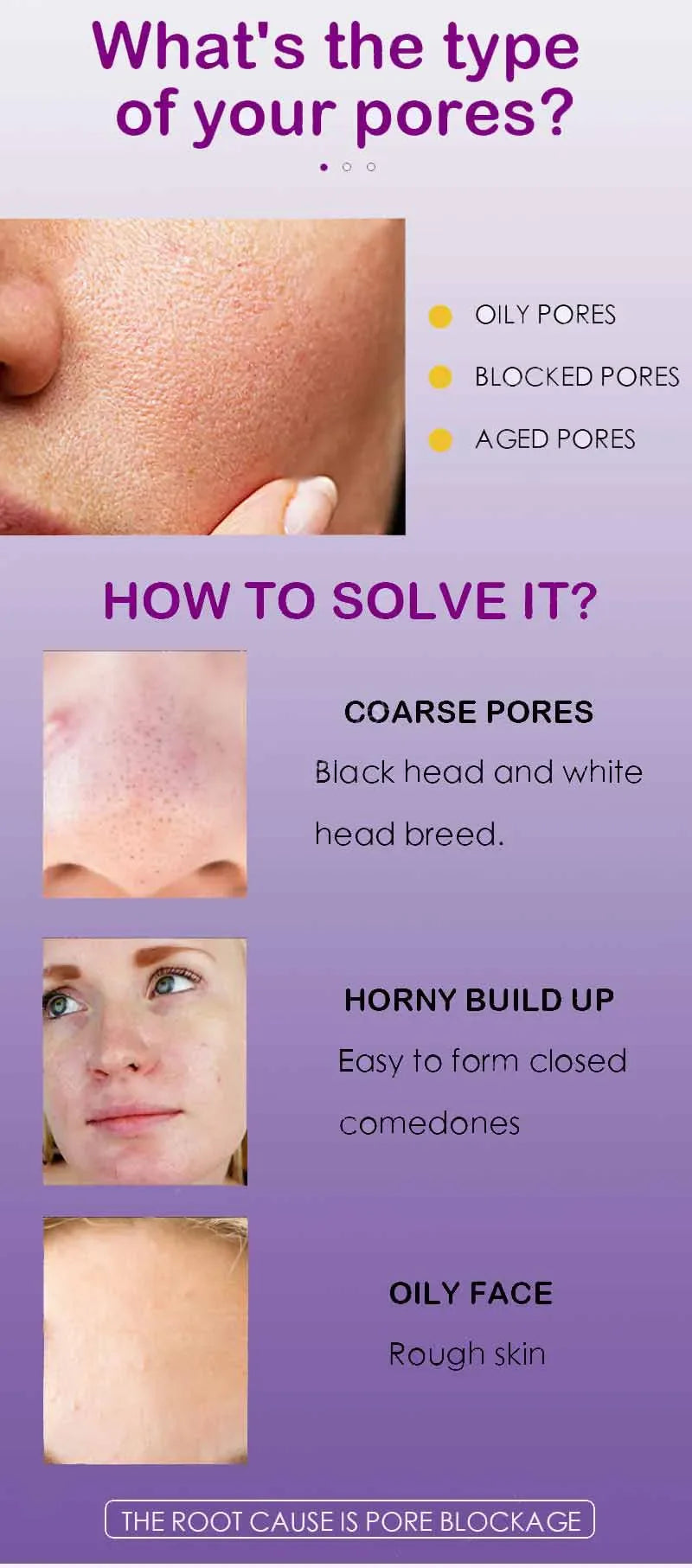 Porifine™ Pore Refining & Brightening Serum MedikStat