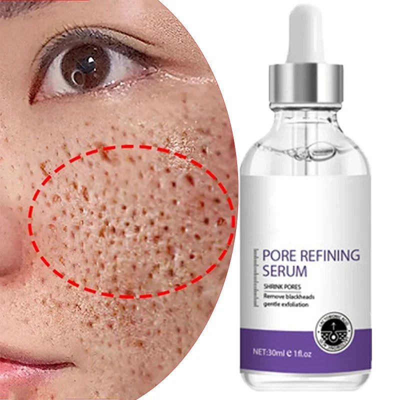 Porifine™ Pore Refining & Brightening Serum MedikStat