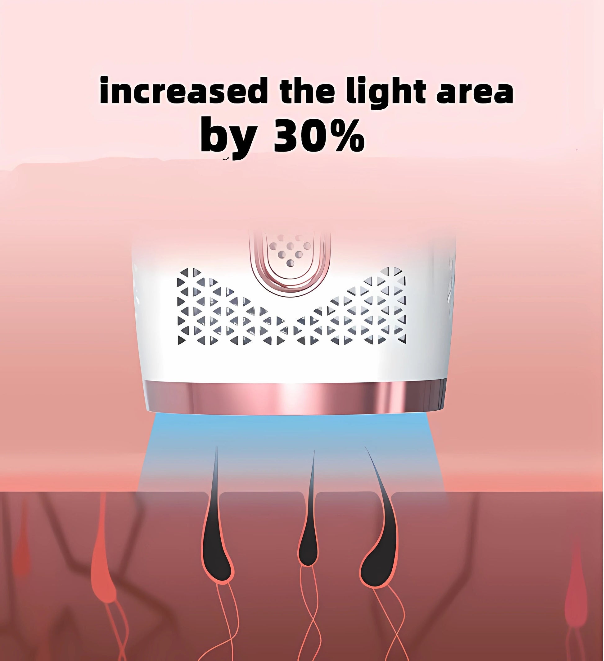Lumoskin™ IPL Laser Hair Removal MedikStat