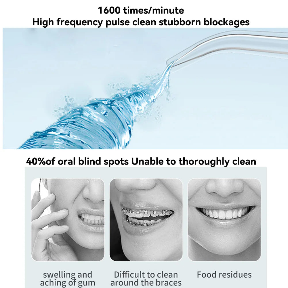 Dental Water Flosser (Rechargeable)