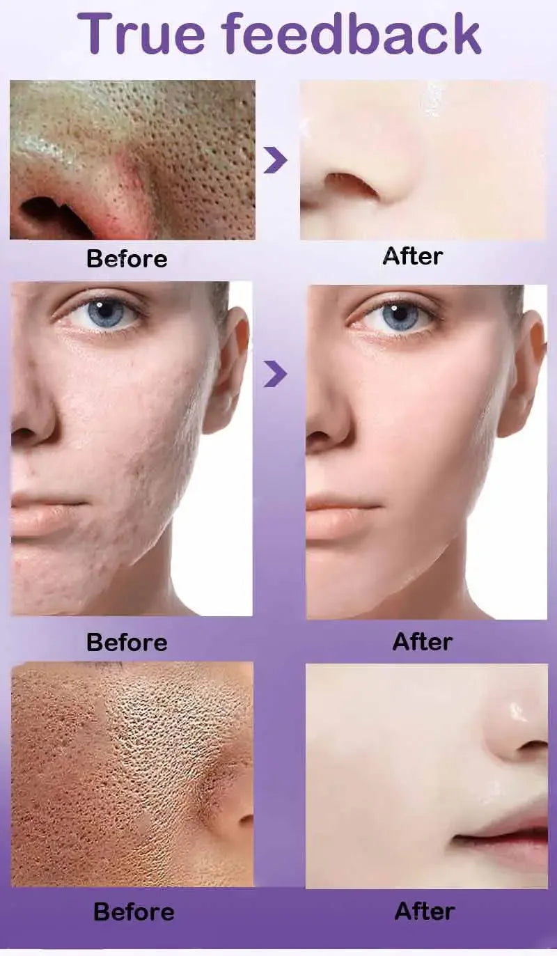 Porifine™ Pore Refining & Brightening Serum MedikStat